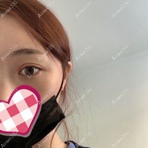 恢复后效果 恢复后效果