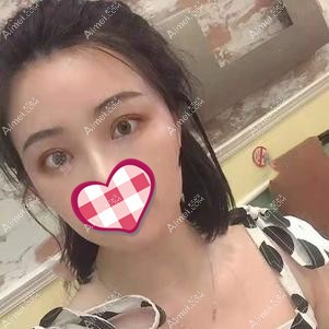 术后一个月效果 术后一个月效果