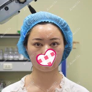 术后即刻效果 术后即刻效果