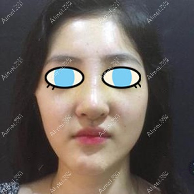 前