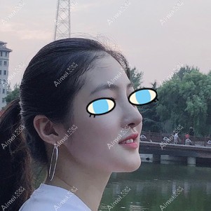 鼻综合半个月效果 鼻综合半个月效果