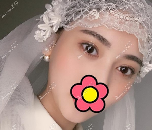 芜湖伊莱美徐世龙做眼睛怎么样 芜湖伊莱美徐世龙做眼睛怎么样