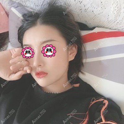 昆明铜雀台发来了好几例周柯医生做的鼻子案例,风格偏自然