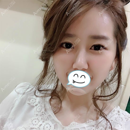 热玛吉18天_meitu_3.jpg