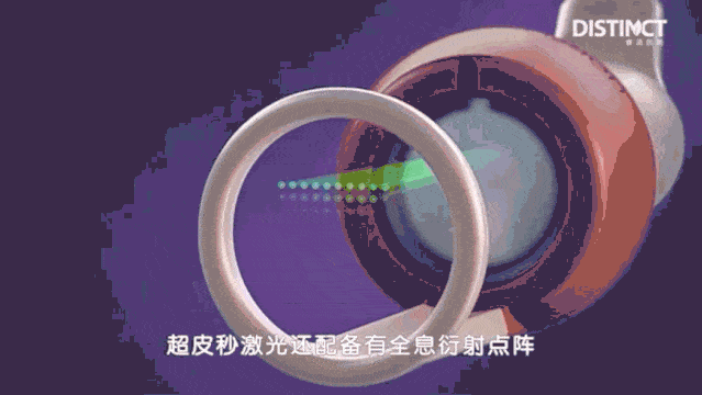 超皮秒祛斑原理及过程图解 超皮秒祛斑原理及过程图解