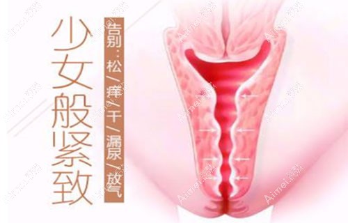 嘉兴曙光整形做3d生物束带紧缩术收费标准爆料给大家