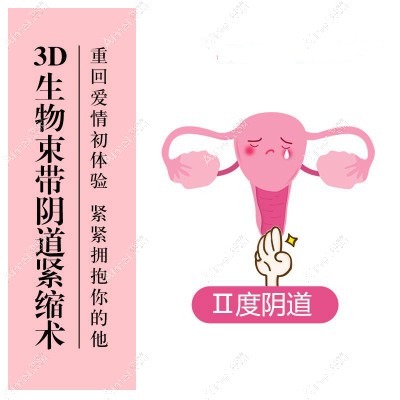 3d生物束带术紧缩收费价格 3d生物束带术紧缩收费价格