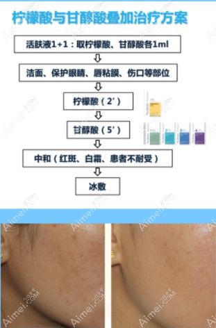 20201222768927.jpg 祛斑_副本.jpg