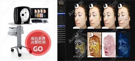 激光去黄褐斑前用美国VISIA皮肤检测.jpg 激光去黄褐斑前用美国VISIA皮肤检测.jpg