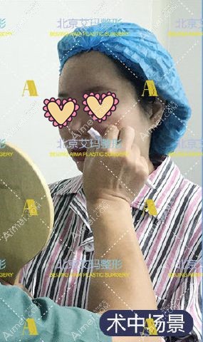 北京艾玛李方奇院长取面部生长因子术前设计.jpg 北京艾玛李方奇院长取面部生长因子术前设计.jpg