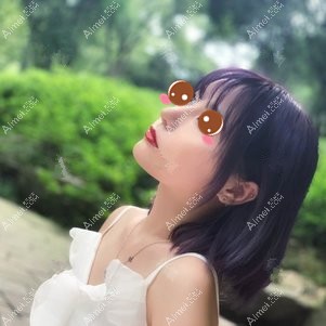 找付俊俐医生做膨体隆鼻术后124天 找付俊俐医生做膨体隆鼻术后124天