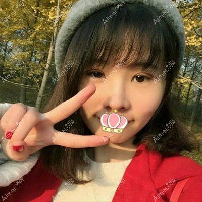 内江达芬奇眼睛整形术后5天恢复效果图 内江达芬奇眼睛整形术后5天恢复效果图
