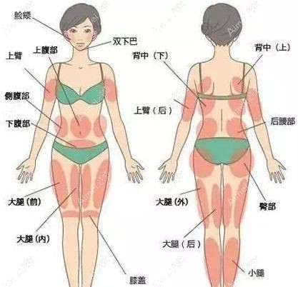 北京润美玉之光5G天使光雕的身体各部位吸脂示意图.jpg 北京润美玉之光5G天使光雕的身体各部位吸脂示意图.jpg