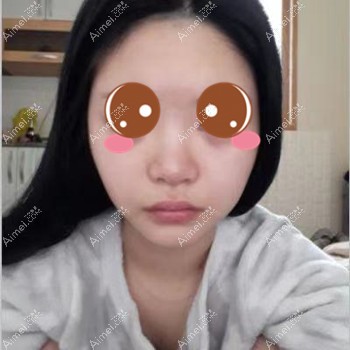 在武汉五洲莱美做脂肪填充术前 在武汉五洲莱美做脂肪填充术前
