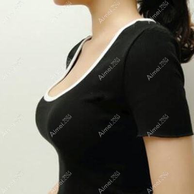傲诺拉假体隆胸术后1个月恢复日记 傲诺拉假体隆胸术后1个月恢复日记