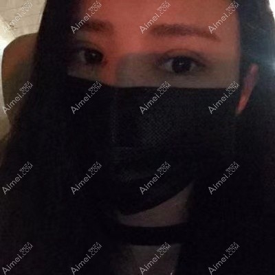 宜昌亚太做双眼皮术后1个月 宜昌亚太做双眼皮术后1个月