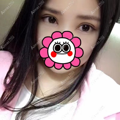 宜昌亚太做双眼皮术后3个月 宜昌亚太做双眼皮术后3个月