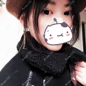 在宜昌蕾帝做全切双眼皮术后36天