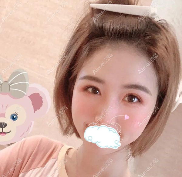 济南艺星美杜莎眼综合术后1个月化妆后效果.jpg 济南艺星美杜莎眼综合术后1个月化妆后效果.jpg