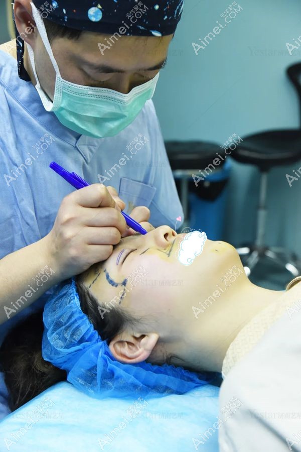 薛提朋医生做美杜莎眼综合术中画线设计.jpg 薛提朋医生做美杜莎眼综合术中画线设计.jpg