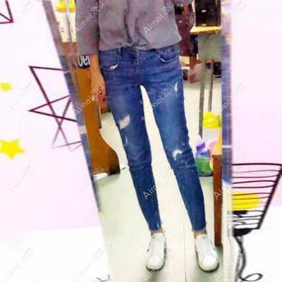 东莞天后乐凤亮吸脂半年恢复效果图 东莞天后乐凤亮吸脂半年恢复效果图