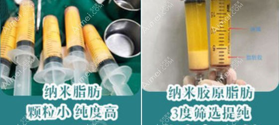 郗敏院长纳米胶原脂肪比纳米脂肪纯度更高.jpg 郗敏院长纳米胶原脂肪比纳米脂肪纯度更高.jpg