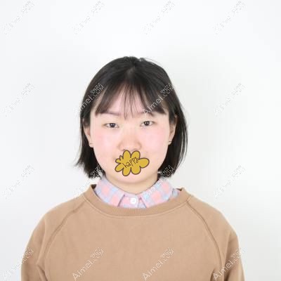 单眼皮美女没来泰安韩美做双眼皮前.jpg 单眼皮美女没来泰安韩美做双眼皮前.jpg