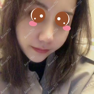 在武汉艺星做鼻综合术后230天