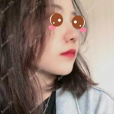 在武汉艺星做鼻综合术后3个月