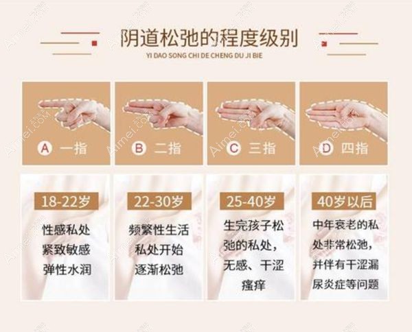 自体脂肪填充缩阴根据阴道松弛程度操作.jpg 自体脂肪填充缩阴根据阴道松弛程度操作.jpg