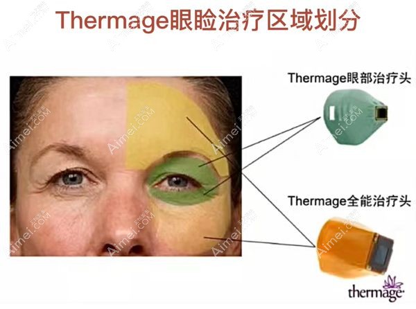 面部热玛吉探头和眼部热玛吉探头的治疗范围.jpg