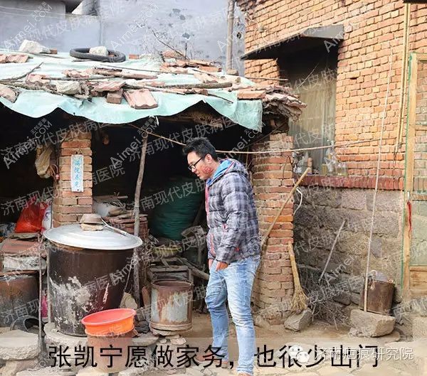 abr消融重建祛烫伤疤术前.jpg abr消融重建祛烫伤疤术前.jpg