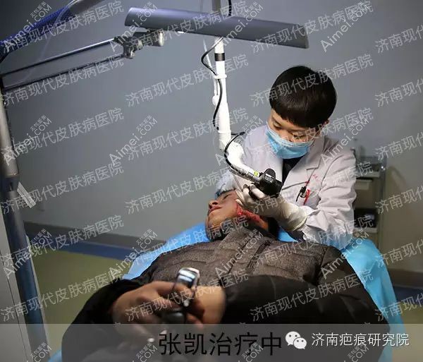 济南现代皮肤病医院的abr消融重建祛疤治疗过程.jpg 济南现代皮肤病医院的abr消融重建祛疤治疗过程.jpg