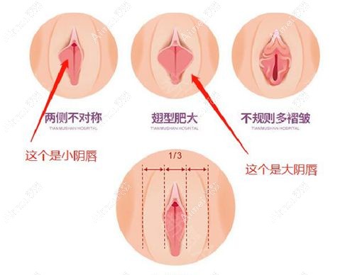 小阴唇和大阴唇的对比示意图.jpg 小阴唇和大阴唇的对比示意图.jpg