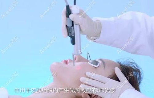 激光提升除皱治疗过程.jpg 激光提升除皱治疗过程.jpg