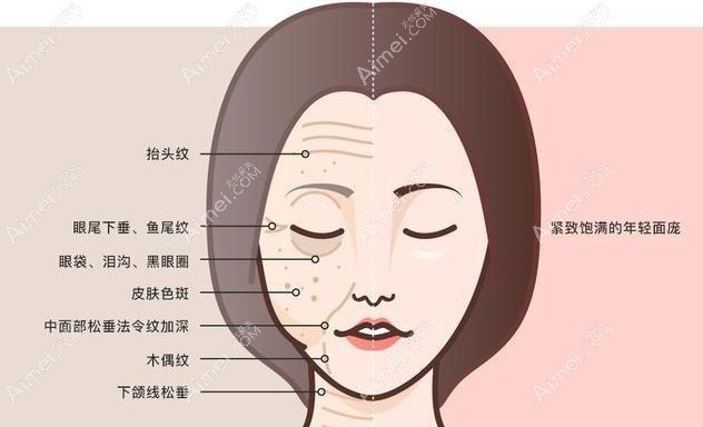 欧洲之星fotona4d面部提升除皱.jpg 欧洲之星fotona4d面部提升除皱.jpg