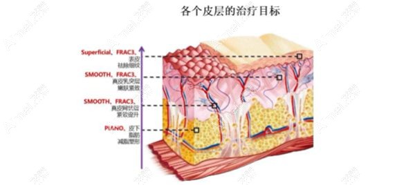 fotona4d面部改善各个层次的治疗情况.jpg fotona4d面部改善各个层次的治疗情况.jpg