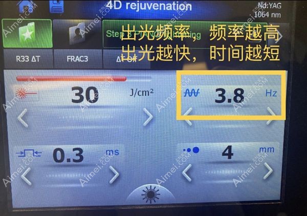 fotona4d出光频率不同疗效就不同.jpg fotona4d出光频率不同疗效就不同.jpg