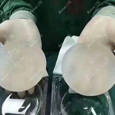 240cc隆胸假体植入前的图片.jpg 240cc隆胸假体植入前的图片.jpg