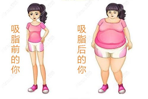 吸脂是目前比较好、比较快速的瘦身减肥方式 吸脂是目前比较好、比较快速的瘦身减肥方式