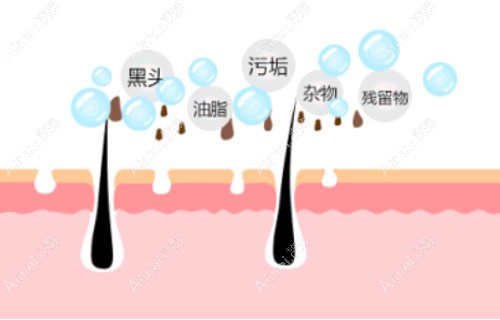 混皮用什么牌子洗面奶好 混皮用什么牌子洗面奶好