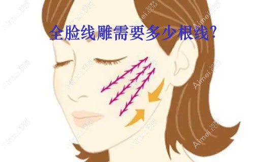 全脸线雕一般多少根线效果好?一边脸用20根大v线和小v线够吗