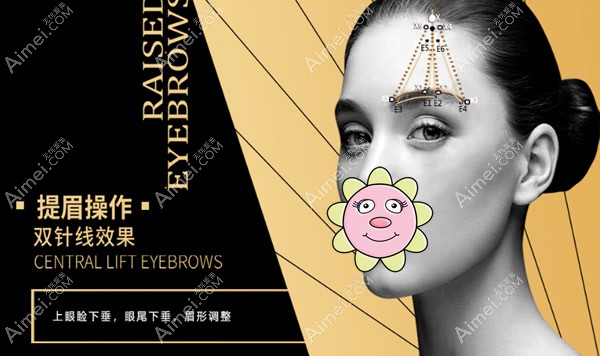 埋线提升提眉需要几根线 埋线提升提眉需要几根线