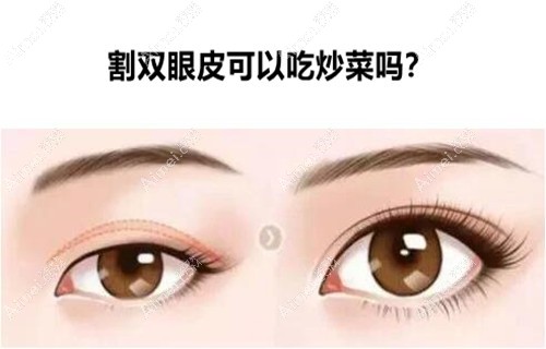 割双眼皮可以吃炒菜吗?割了双眼皮吃什么菜可以更快恢复?