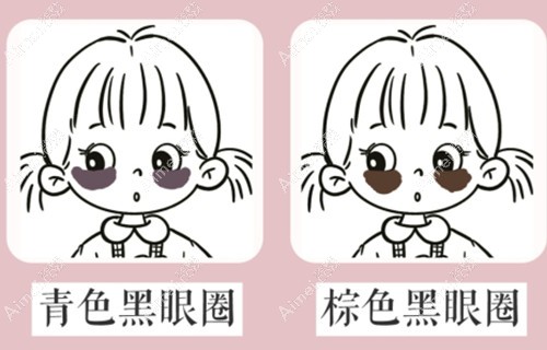 熬夜为什么有黑眼圈？我是稍微熬夜就有黑眼圈怎么办啊
