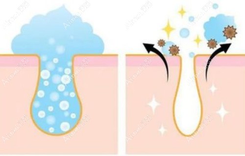 敷完清洁面膜之后可以直接刷水杨酸吗?不知多久刷酸合适呀?