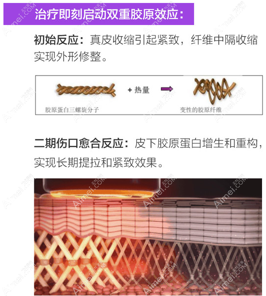 热玛吉和激光祛斑哪个先做好,当然是激光祛斑了 热玛吉和激光祛斑哪个先做好,当然是激光祛斑了