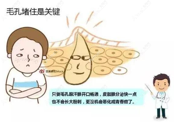 青春痘的治疗方式 青春痘的治疗方式
