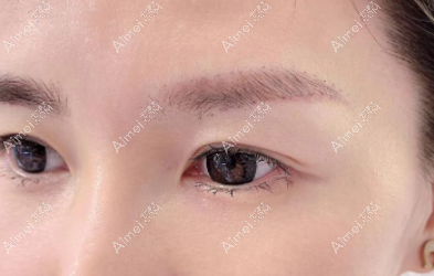 纹眉两年后眉毛变红怎么去掉 纹眉两年后眉毛变红怎么去掉