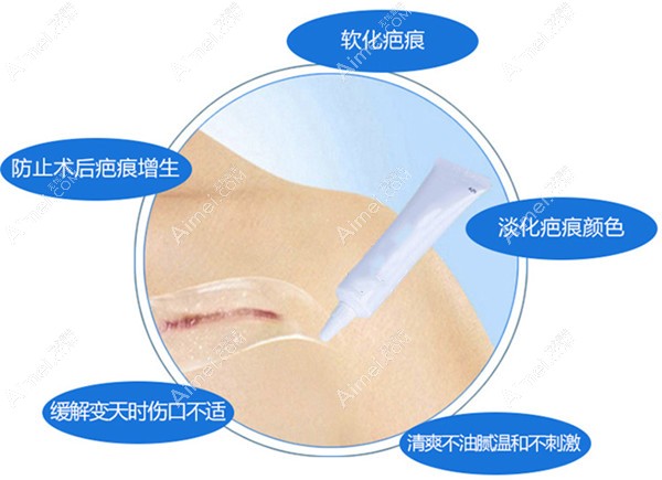涂抹祛疤膏的时间 涂抹祛疤膏的时间